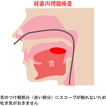 経鼻内視鏡のメリットイメージ